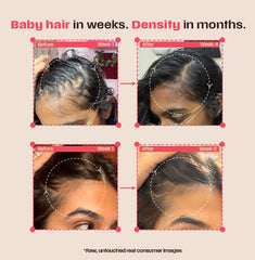 Days Ahead Leave-In Hair Growth Serum | Redensyl, Anagain, Caffeine & Ceramide | Promotes New Hair Growth | Advanced Anti Hair Fall Treatment | Non-Sticky, Oil-Control Formula |For Both Women & Men