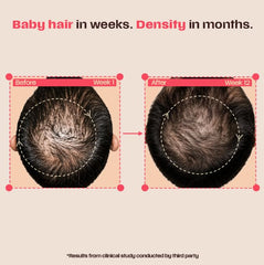 Days Ahead Leave-In Hair Growth Serum | Redensyl, Anagain, Caffeine & Ceramide | Promotes New Hair Growth | Advanced Anti Hair Fall Treatment | Non-Sticky, Oil-Control Formula |For Both Women & Men
