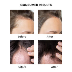 ThriveCo Rosemary Mint Hair Oil | For Hair Growth, Hair fall and Dandruff Control | Smoothens Dry Scalp & Split Ends | Suitable for both Men and Women |50ml