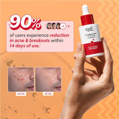 Chemist At Play 2% Salicylic Acid Face Serum for Acne-Prone Skin | Treats Active Acne & Controls Oil | Fades Acne Marks | Improves Skin Texture | Lightweight, Non-Comedogenic | For Men & Women | 30 ml