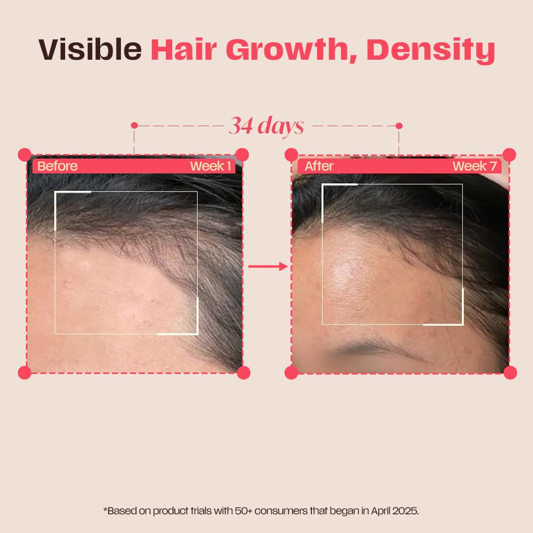 Days Ahead Leave-in Hair Growth Ampoule Serum (Roll on) | 16% Growth Actives | PDRN, Redensyl, Anagain | Hair Growth Serum | Promotes Growth, Increases Density | Non-Greasy | For Women & Men | 25 ml