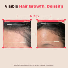 Days Ahead Leave-in Hair Growth Ampoule Serum (Roll on) | 16% Growth Actives | PDRN, Redensyl, Anagain | Hair Growth Serum | Promotes Growth, Increases Density | Non-Greasy | For Women & Men | 25 ml