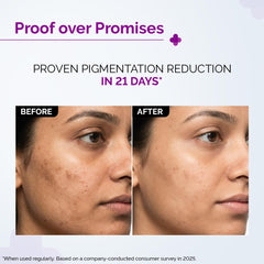 The Derma Co. 2% Kojic Acid Face Serum with Alpha Arbutin, Powered by Deep Penetration Formula™ | Fights Pigmentation | Fades Dark Spots | Brightens & Evens Skin Tone | 30 ml