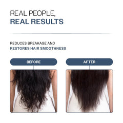 Bare Anatomy Anti-Hair Fall Conditioner for Hair Fall with Redensyl, Rosemary & Peptides | Reduces Hair Thinning & Breakage | Strengthens Hair, Reduces Frizz & Adds Shine | For All Hair Types | 175gm