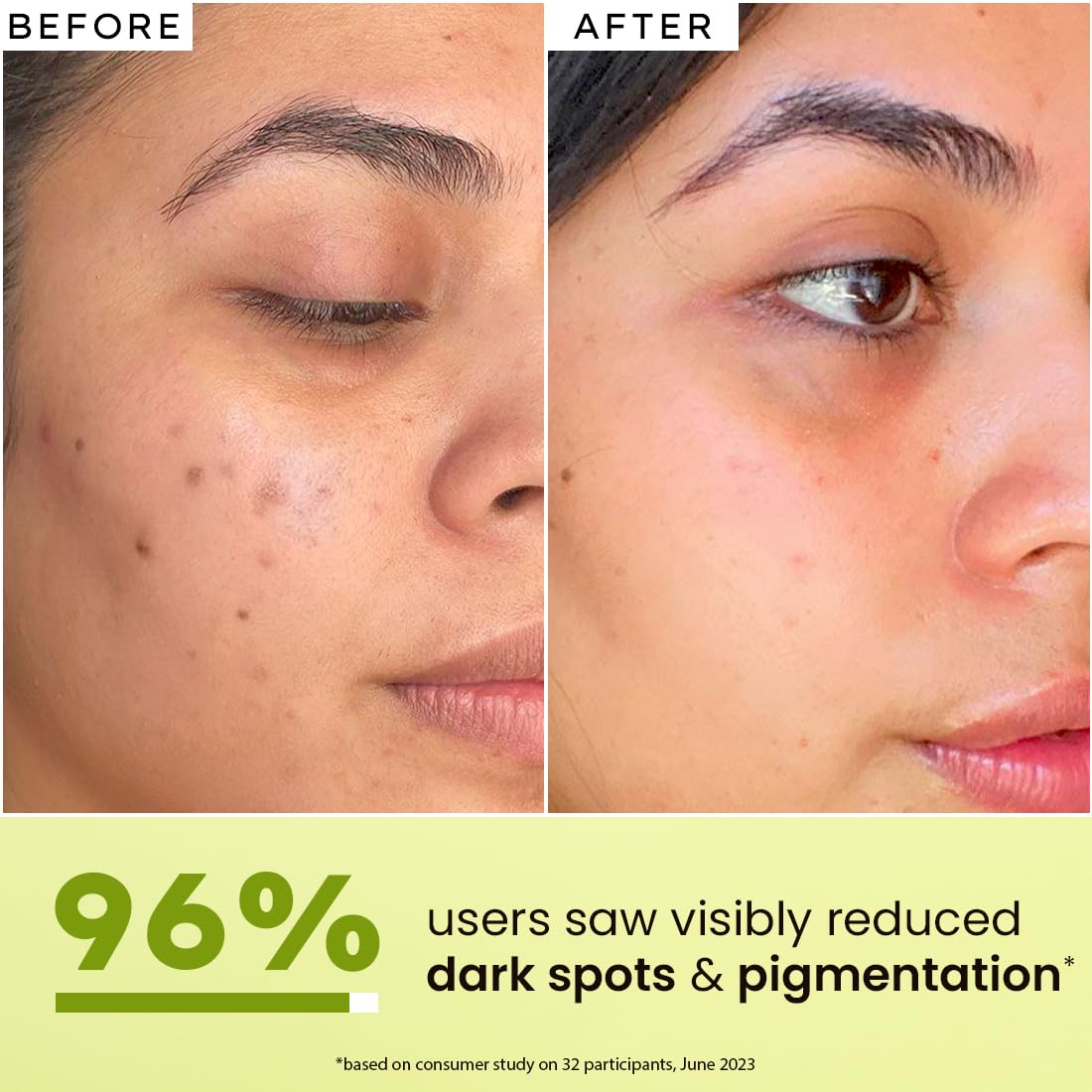 Hyphen 5% Niacinamide, 1% Alpha Arbutin & 25% Kakadu Plum Brightening Face Serum | 20X Vitamin C for Glowing Summer Skin | Hydrating Serum for Dark Spots, Pigmentation & Dryness | All Skin Types