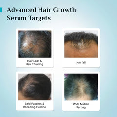 PILGRIM Redensyl 3%+Anagain 4% Advanced Hair Growth Serum For Scalp(50Ml) With Natural Ingredients Korean Black Rice,Controls Hair Fall,Stimulates,Increases Hair Density|Hairgrowth Serum For Unisex