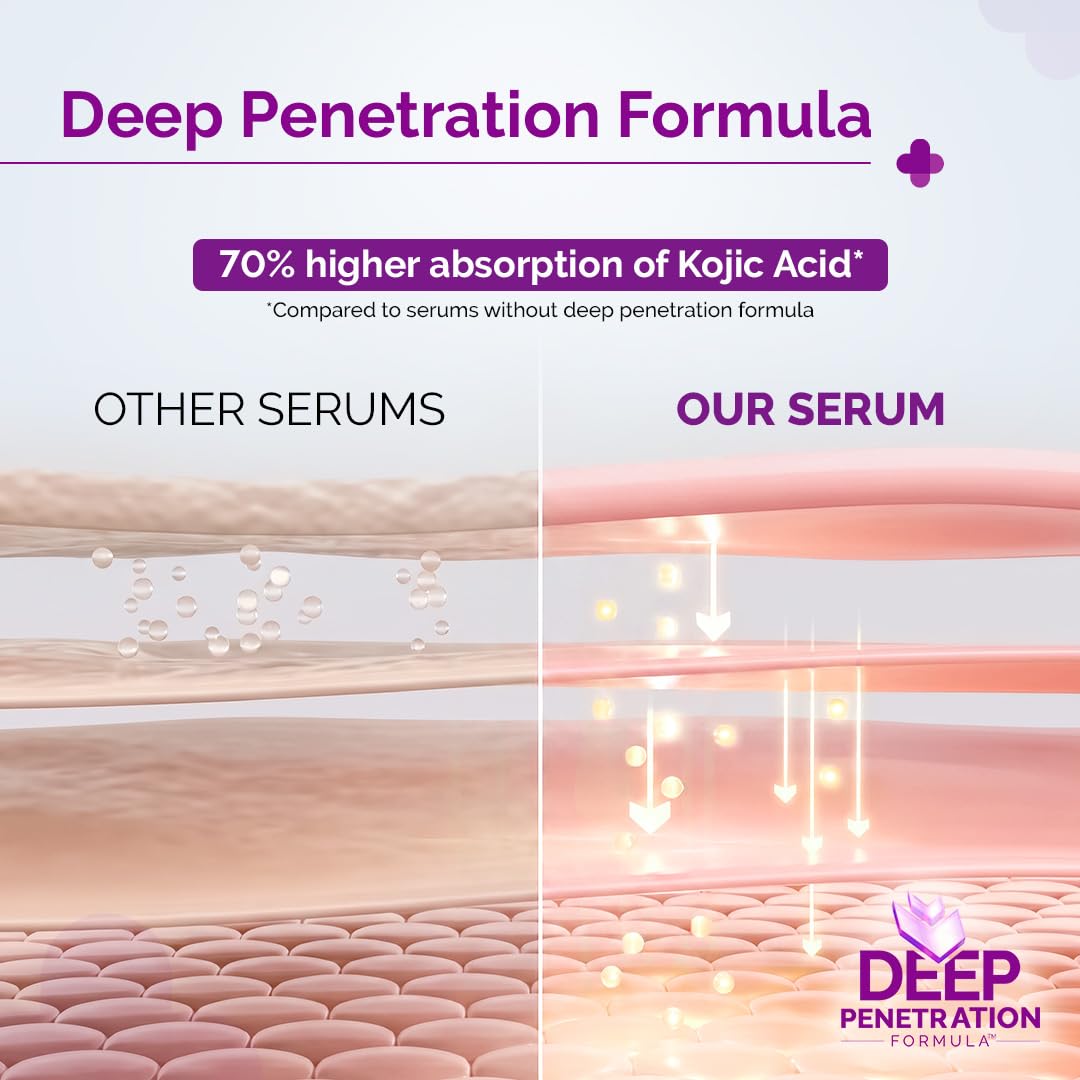 The Derma Co. 2% Kojic Acid Face Serum with Alpha Arbutin, Powered by Deep Penetration Formula™ | Fights Pigmentation | Fades Dark Spots | Brightens & Evens Skin Tone | 30 ml