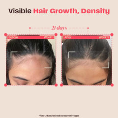 Days Ahead Leave-in Hair Growth Ampoule Serum (Roll on) | 16% Growth Actives | PDRN, Redensyl, Anagain | Hair Growth Serum | Promotes Growth, Increases Density | Non-Greasy | For Women & Men | 25 ml
