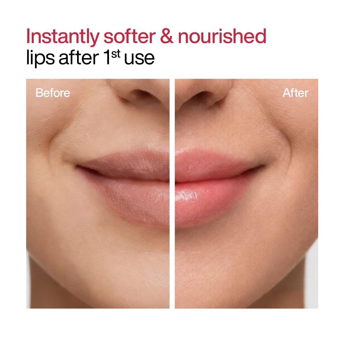 WishCare Tinted Lip Balm SPF 50 PA++++ | Brightening Lip Balm for Dark Lips | In-Vivo Tested | Kojic Acid & Niacinamide | For Women | 5g (packaging may vary)
