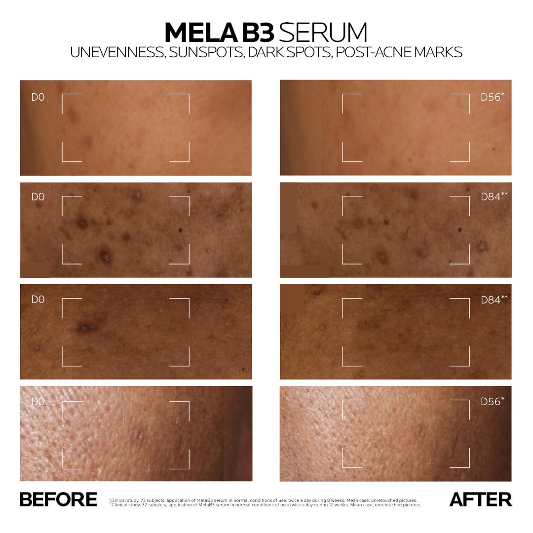 La Roche-Posay Mela B3 Anti-Dark Spot Serum with Melasyl & Niacinamide 30ml