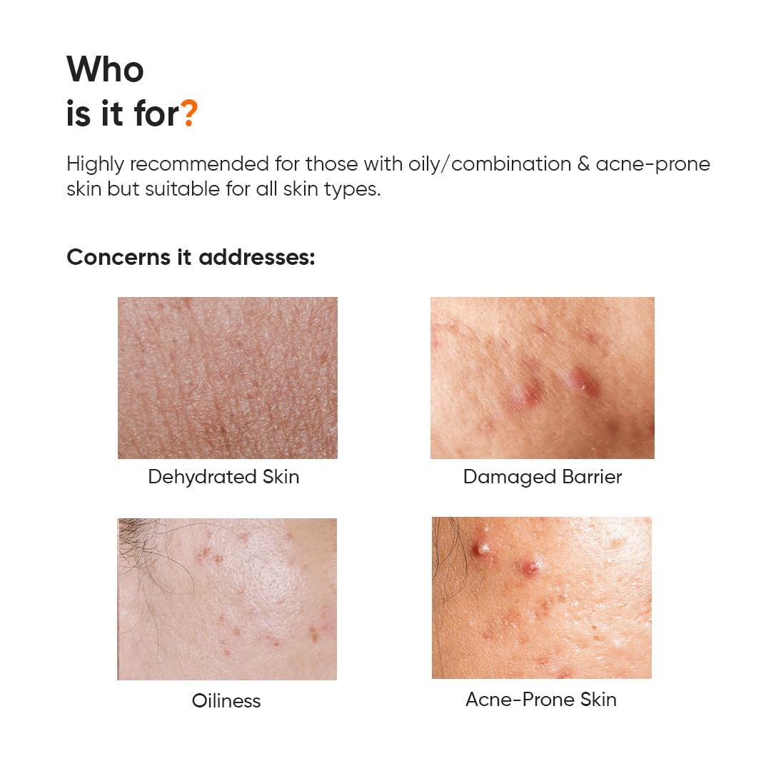 Minimalist Dehydrated Skin Moisturizer with 10% Vitamin B5 for Oily & Acne-Prone Skin | Oil-Free Hydration & Lightweight Gel Formula for Damaged Barrier Repair | Fast-Absorbing & Non-Sticky Lightweight Winter Cream For Women & Men | Fragrance-Free | 50 gr