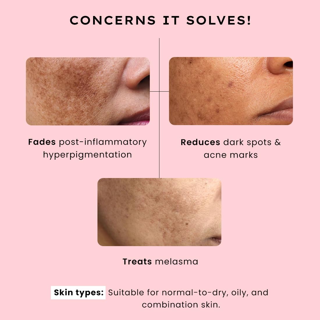 Hyphen 4% Tranexamic Acid + 5% Niacinamide Biphasic De-Pigmentation Serum | Correction & Prevents Hyperpigmentation, Dark Spots & Melasma| In-vivo tested & Non-Comedogenic| Deep Penetration - 30 ml