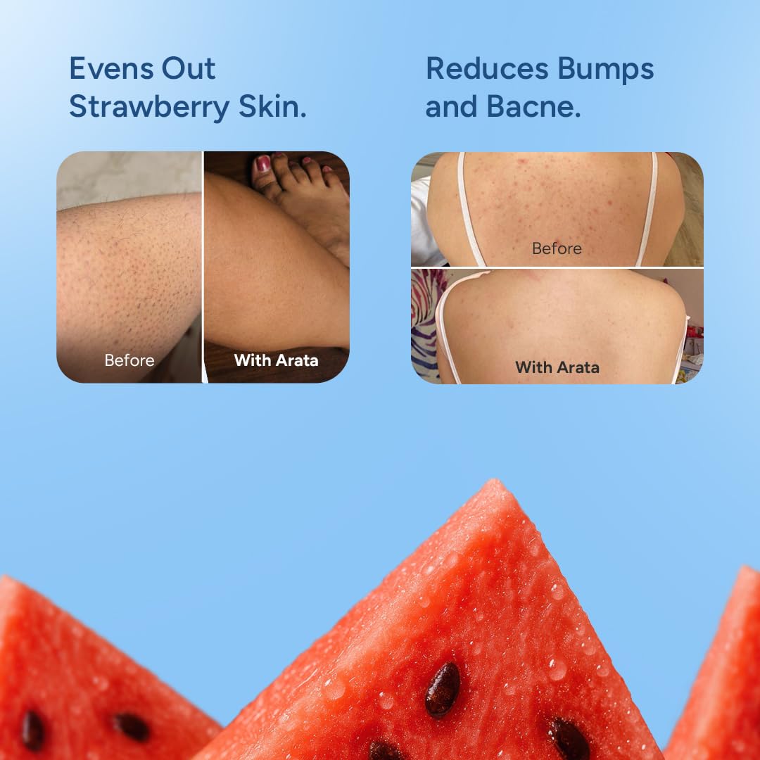 Arata 1% Salicylic Acid Body Wash I 300 ML I Removes Back Acne I Improves Strawberry Skin I Cleanses, Smoothens and Exfoliates Skin I Prevents Body Acne and Bumps I with Watermelon Fragrance