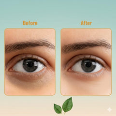ETSAP Hydra Anti Wrinkle Eye Serum Patch| Treats Dark Circles, Fine Lines And Wrinkles | Enriched With Collagen And Aloe Vera Extract | Shade -Gold, 60 Pcs