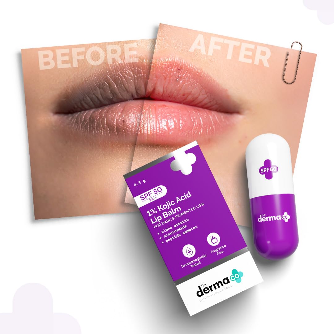 The Derma Co 1% Kojic Acid Lip Balm with SPF 50 PA +++ I With Arbutin & Peptide Complex | Reduce Lip Pigmentation | Protects From Sun Damage | For Dark, Pigmented Lips | For Men & Women | 4.5 g