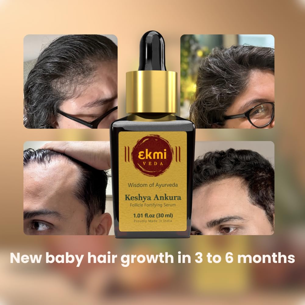 Ekmiveda Hair Growth DHT Blocker Serum with Redensyl, Procapil, Ayurvedic herbs, Amla, Brahmi, Capilia longa. Follicle stimulating serum. Hair loss treatment for women & men, thicker hair 1.01 fl oz