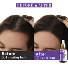 Sesa Rosemary Essential Oil For Hair Growth Nourishes Skin | Hair Fall Control | Women and Men 100% Pure & Natural Rosemary Oil |15 ml