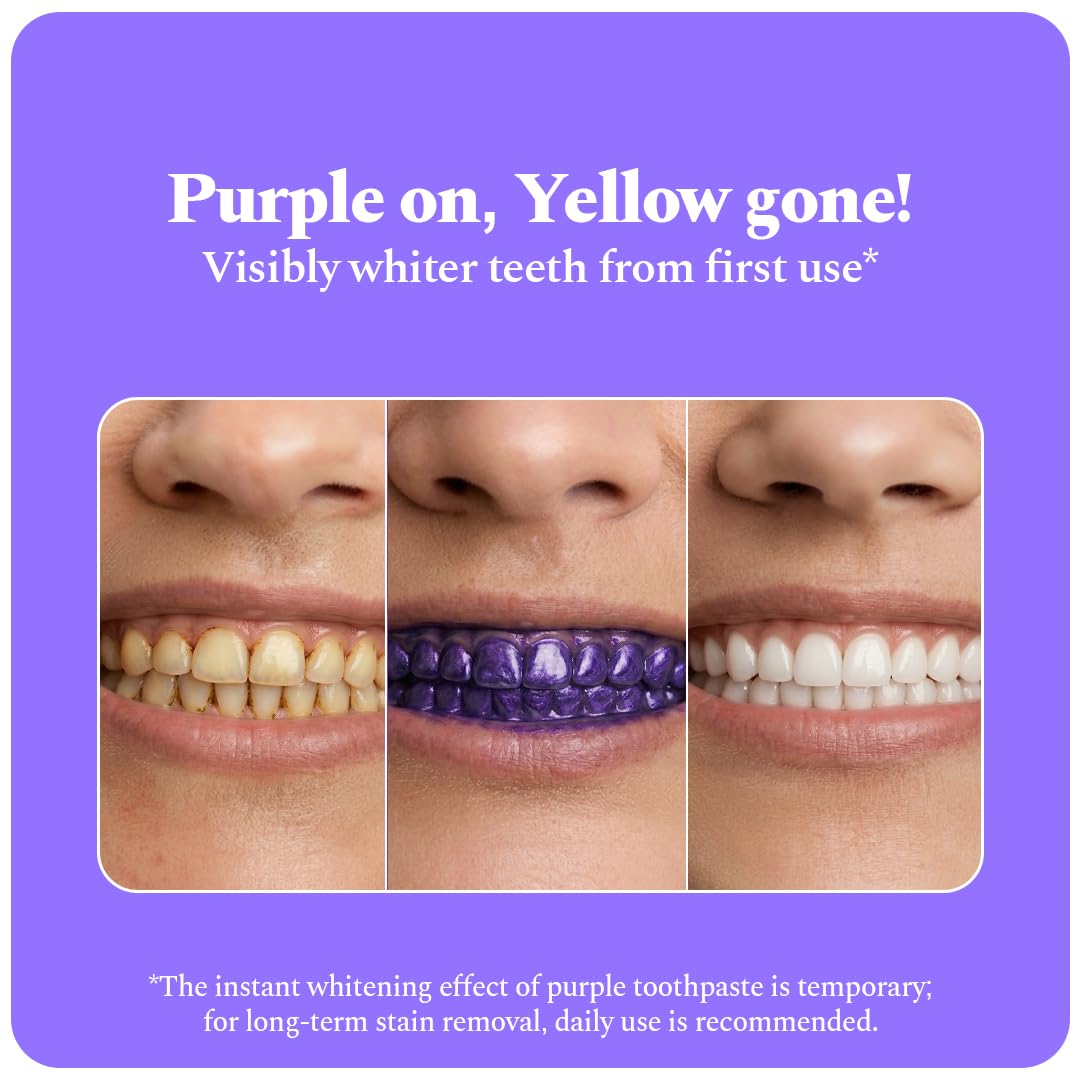 Perfora Purple Whitening Toothpaste-125g | Purple Toothpaste For Teeth Whitening | Teeth Stain Remover | Enamel Safe & Effective Teeth Whitener Oral care | Grape Mint