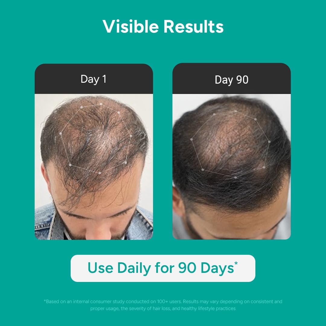 Arata Hair Growth Serum (30ml) with 3% Redensyl, 3% Procapil, 5% Kopexil, Caffeine & Rice Water | No Minoxidil | Supports Hair Growth | Helps Reduce Hairfall | Serum For Women and Men