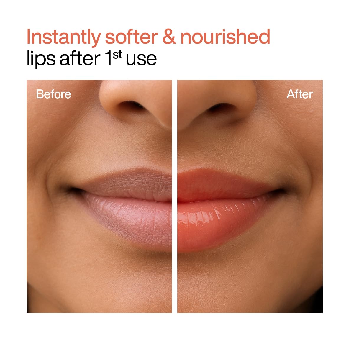 WishCare Tinted Lip Balm SPF 50 PA++++ | Brightening Lip Balm for Dark Lips | In-Vivo Tested | Kojic Acid & Niacinamide | For Women | 5g (Coral Peach)
