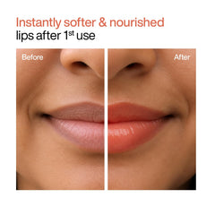 WishCare Tinted Lip Balm SPF 50 PA++++ | Brightening Lip Balm for Dark Lips | In-Vivo Tested | Kojic Acid & Niacinamide | For Women | 5g (Coral Peach)