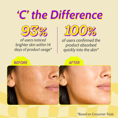 Chemist At Play 10% Vitamin C Serum for Glowing Skin | Pigmentation & Dark Spots | Skin Brightening Face Serum | With Ethyl Ascorbic Acid, Lactic Acid & Glucosamine | For Men & Women | 30 ml