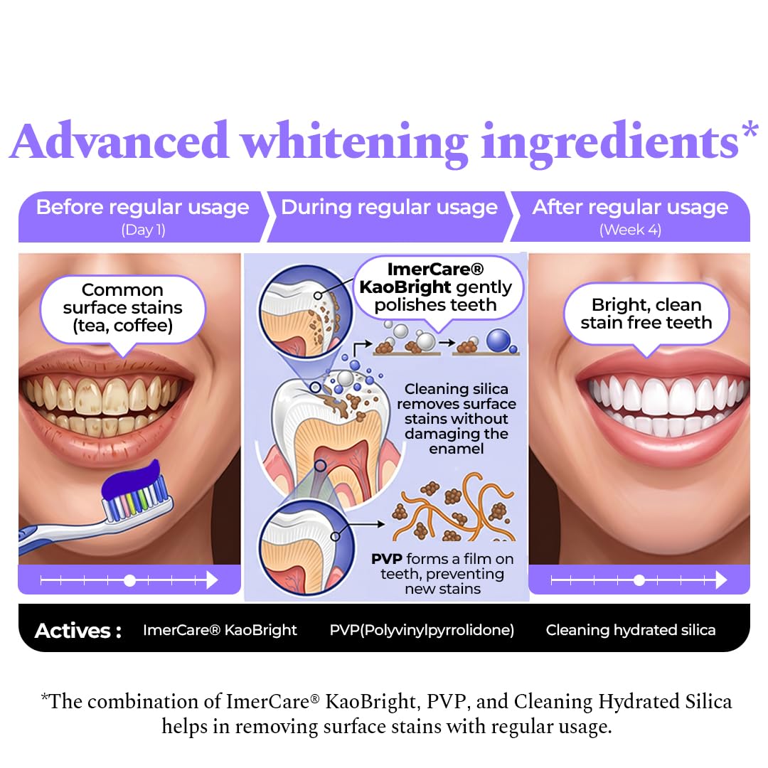 Perfora Purple Whitening Toothpaste-125g | Purple Toothpaste For Teeth Whitening | Teeth Stain Remover | Enamel Safe & Effective Teeth Whitener Oral care | Grape Mint