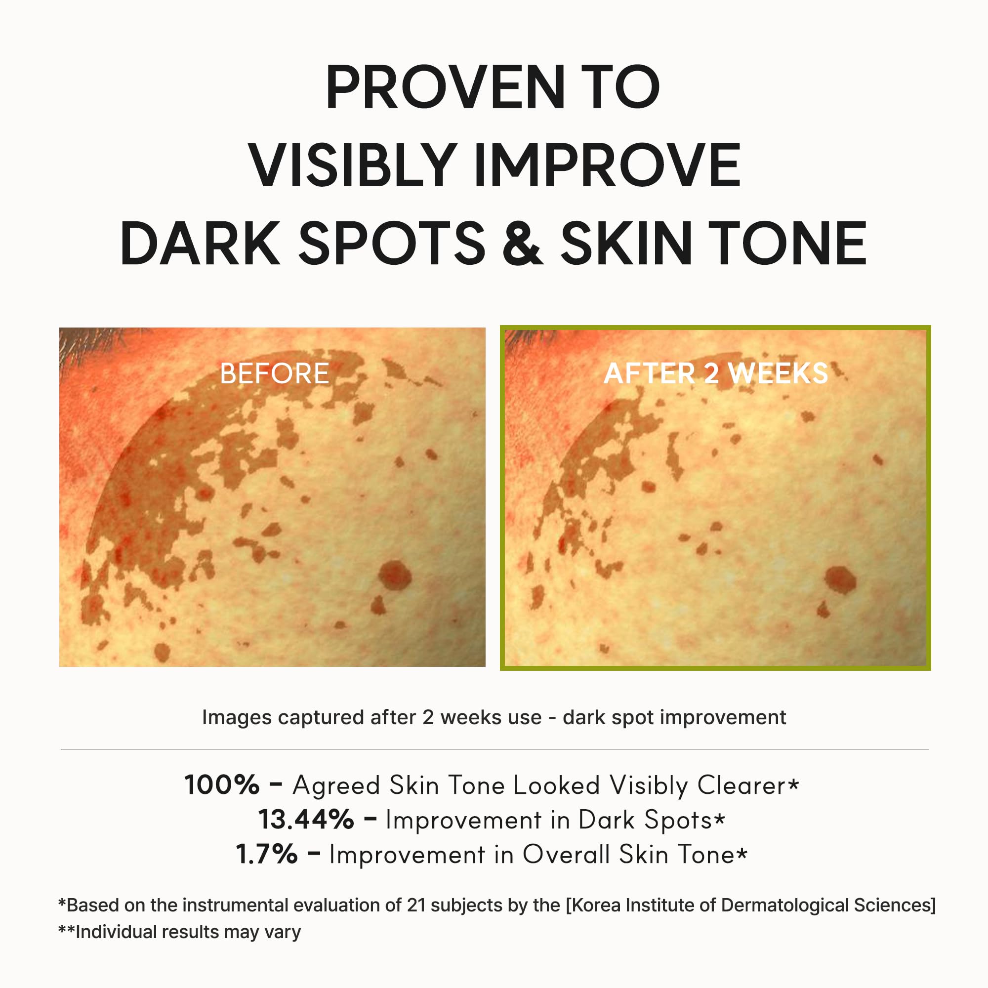 Arencia Vitamin C Booster Shot, 5% Dual Vitamin C + Glutathione Serum for Dark Spot Care