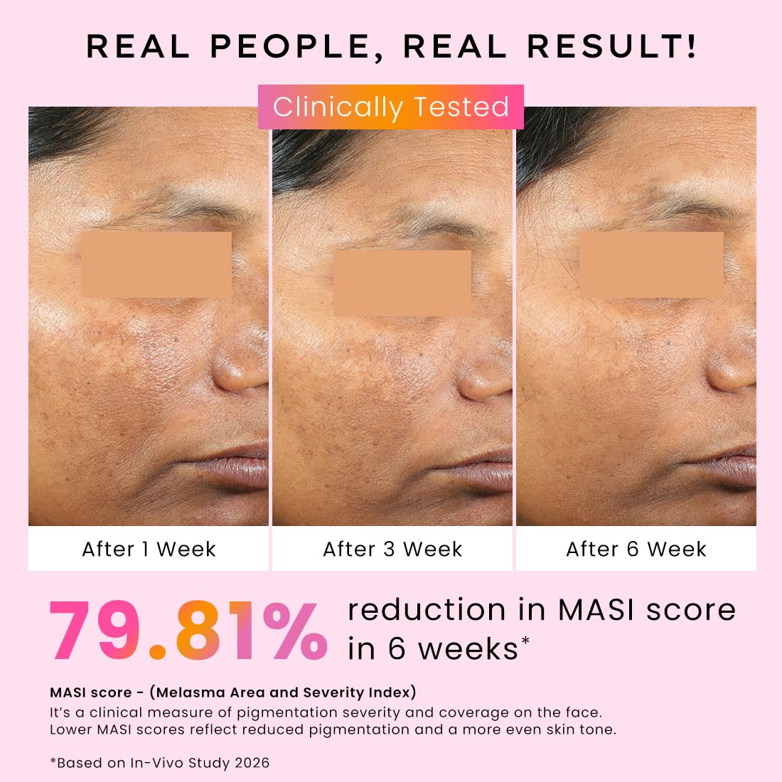 Hyphen 4% Tranexamic Acid + 5% Niacinamide Biphasic De-Pigmentation Serum | Correction & Prevents Hyperpigmentation, Dark Spots & Melasma| In-vivo tested & Non-Comedogenic| Deep Penetration - 30 ml