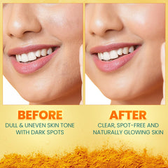 Himalaya Wellness Company Himalaya Dark Spot Clearing Turmeric Face Serum Organically Sourced Turmeric Reduce Dark Spots In 7 Days 10% Glycolic Acid & 2% Niacinamide 30Ml