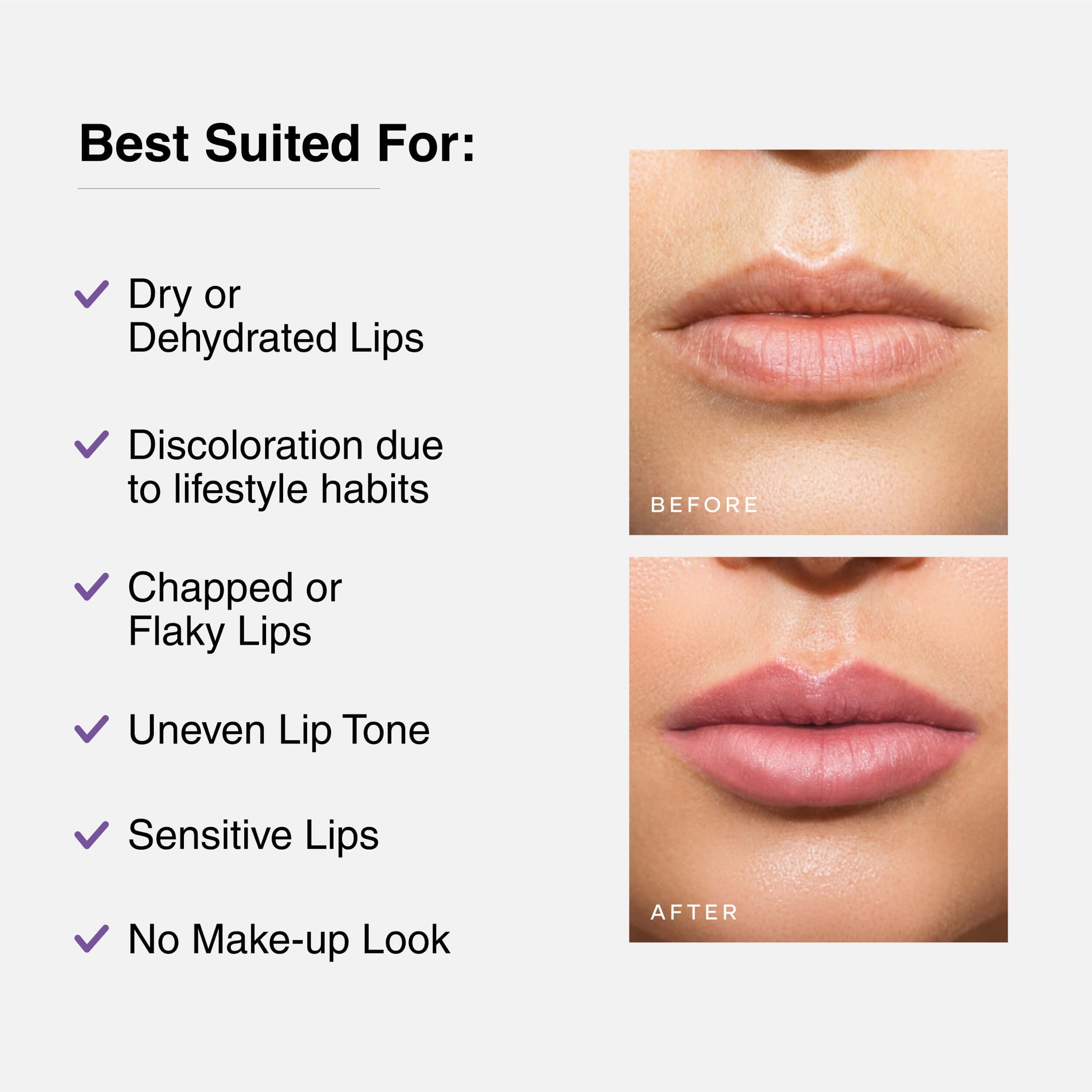 Cureskin Tinted Lip Balm For Women And Men |Hydrates & Protects For Lip Tint With Beetroot,Carrot & Strawberry |Lip Lightening Balm For Dark Lips |Tinted Lip Balm For Dark Lips To Lighten,1 Count
