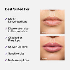 Cureskin Tinted Lip Balm For Women And Men |Hydrates & Protects For Lip Tint With Beetroot,Carrot & Strawberry |Lip Lightening Balm For Dark Lips |Tinted Lip Balm For Dark Lips To Lighten,1 Count