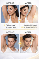 Kalyra Underarm Roll-On Deodorant, 5% Potassium, Brightening, Odour Control & Smooth Skin, for Men & Women