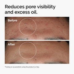 The Ordinary Niacinamide 10% + Zinc 1%, Brightening & Smoothing Serum for Blemish-Prone Skin, 60ml