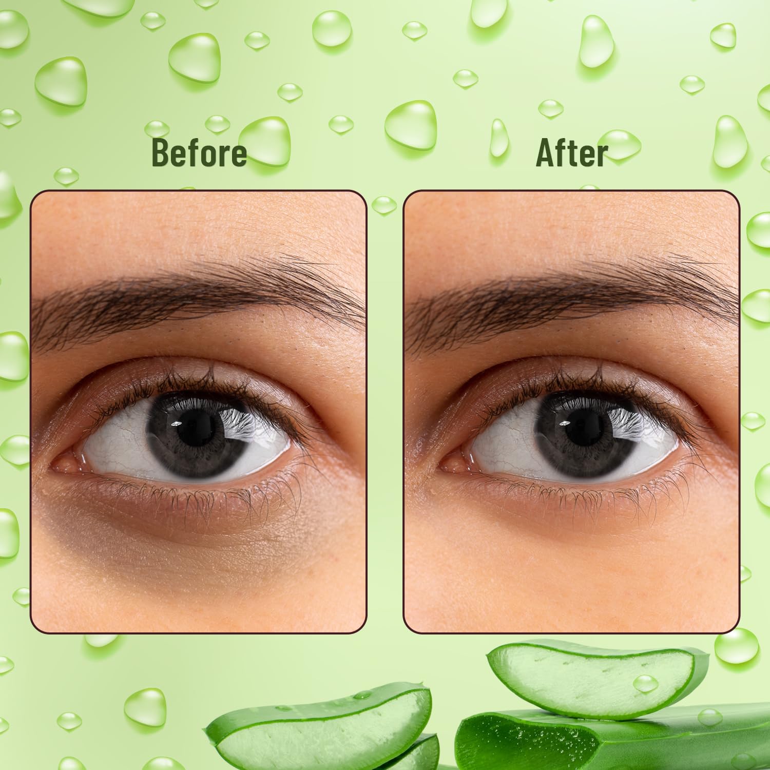 Swiss Beauty Hydra Anti Wrinkle Eye Serum Patch| Treats Dark Circles, Fine Lines And Wrinkles | Enriched With Collagen And Aloe Vera Extract | Shade- 01 Aloevera, 60 Pcs