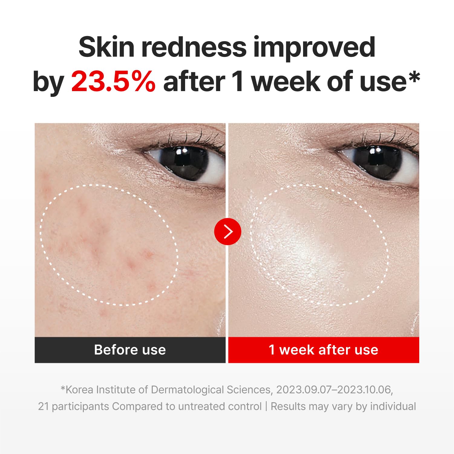 Centellian 24 - Madeca Cream Time Reverse Mini 15 ml, Brightens and evens dullness, Korean Skincare