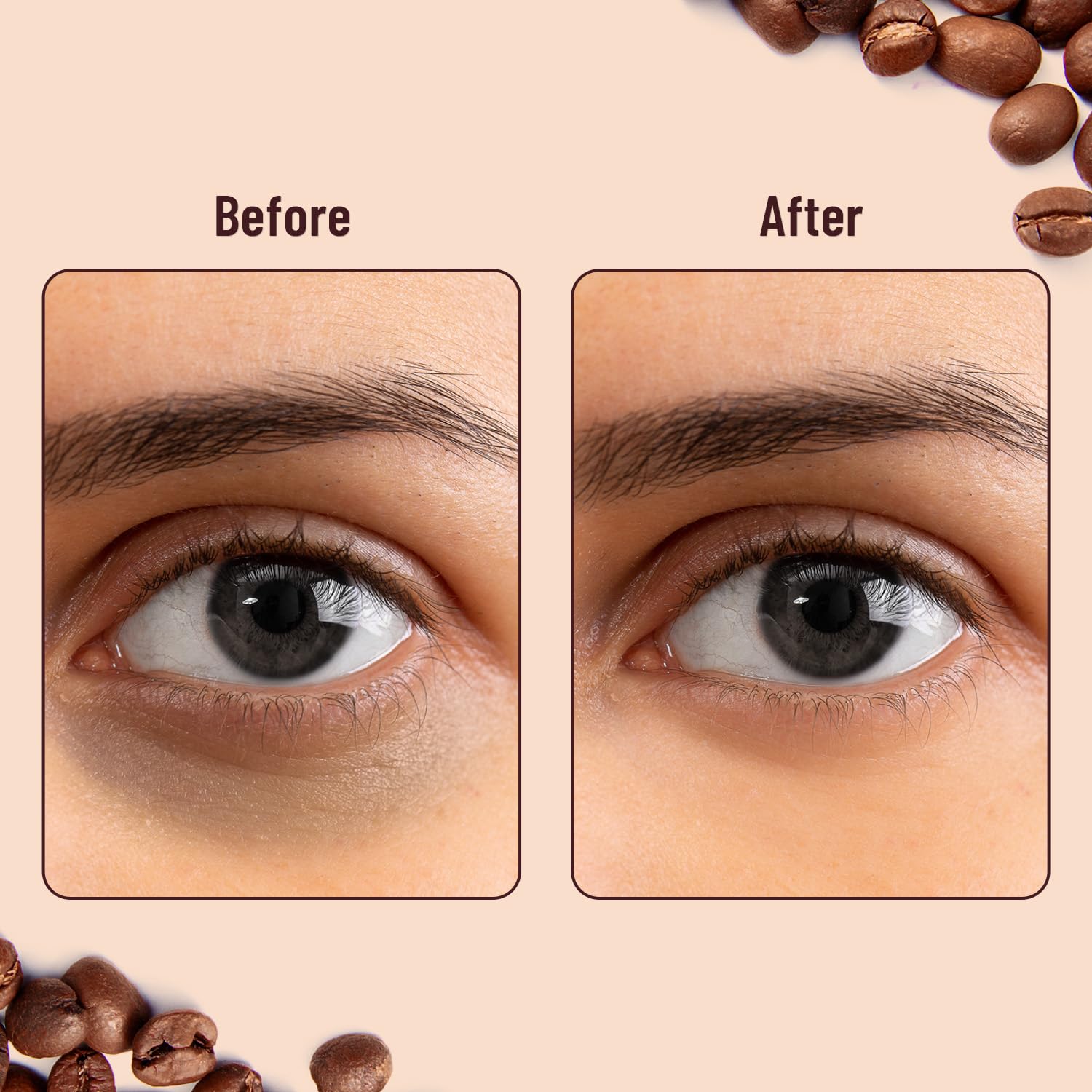 Swiss Beauty Hydra Anti Wrinkle Eye Serum Patch| Treats Dark Circles, Fine Lines And Wrinkles | Enriched With Collagen And Aloe Vera Extract | Shade - 03 Coffee, 60 Pcs