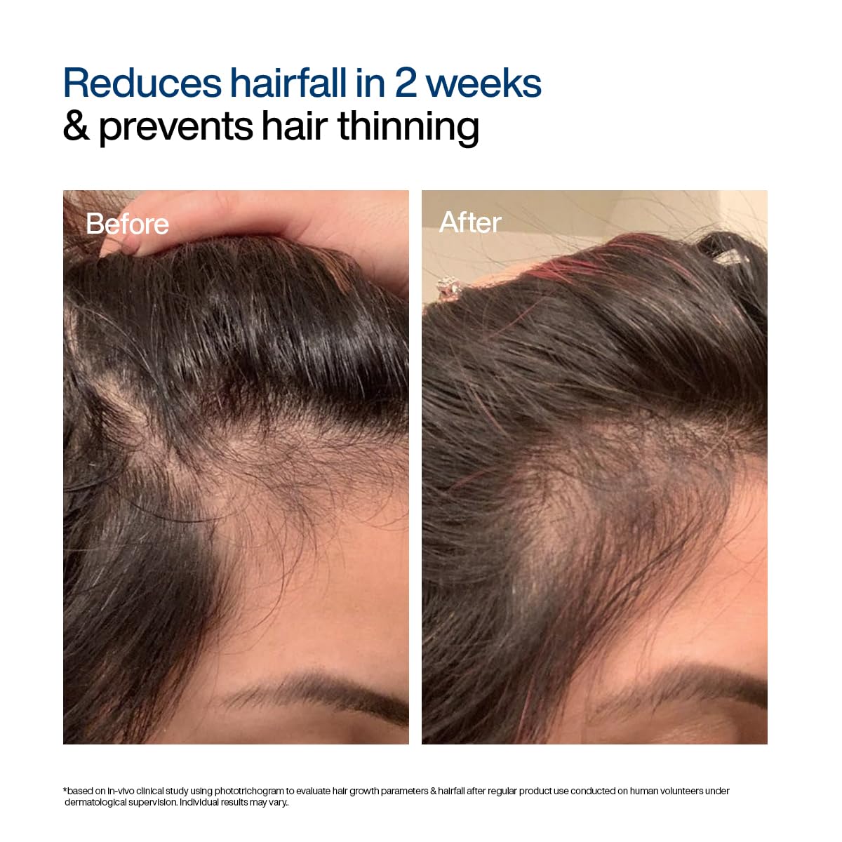 WishCare Hair Growth Serum Concentrate - Resdensyl, Anagain, Caffeine, Biotin, Keratin & Rice Water 20ml