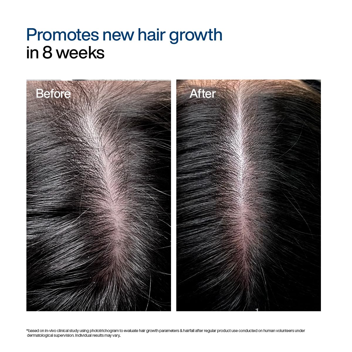 WishCare Hair Growth Serum Concentrate - Resdensyl, Anagain, Caffeine, Biotin, Keratin & Rice Water 20ml
