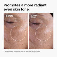 The Ordinary Glycolic Acid 7% Exfoliating Toner, Brightening and Smoothing Daily Toner for More Even-Looking Skin Tone, 100ml