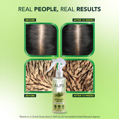 Alps Goodness Rosemary Water Spray for Hair Growth (250ml) | Clinically Proven (In Vivo Tested) to Reduce Hair Fall & Promote Regrowth | 100% Natural Rosemary Extract | Leave-On Scalp & Hair Spray
