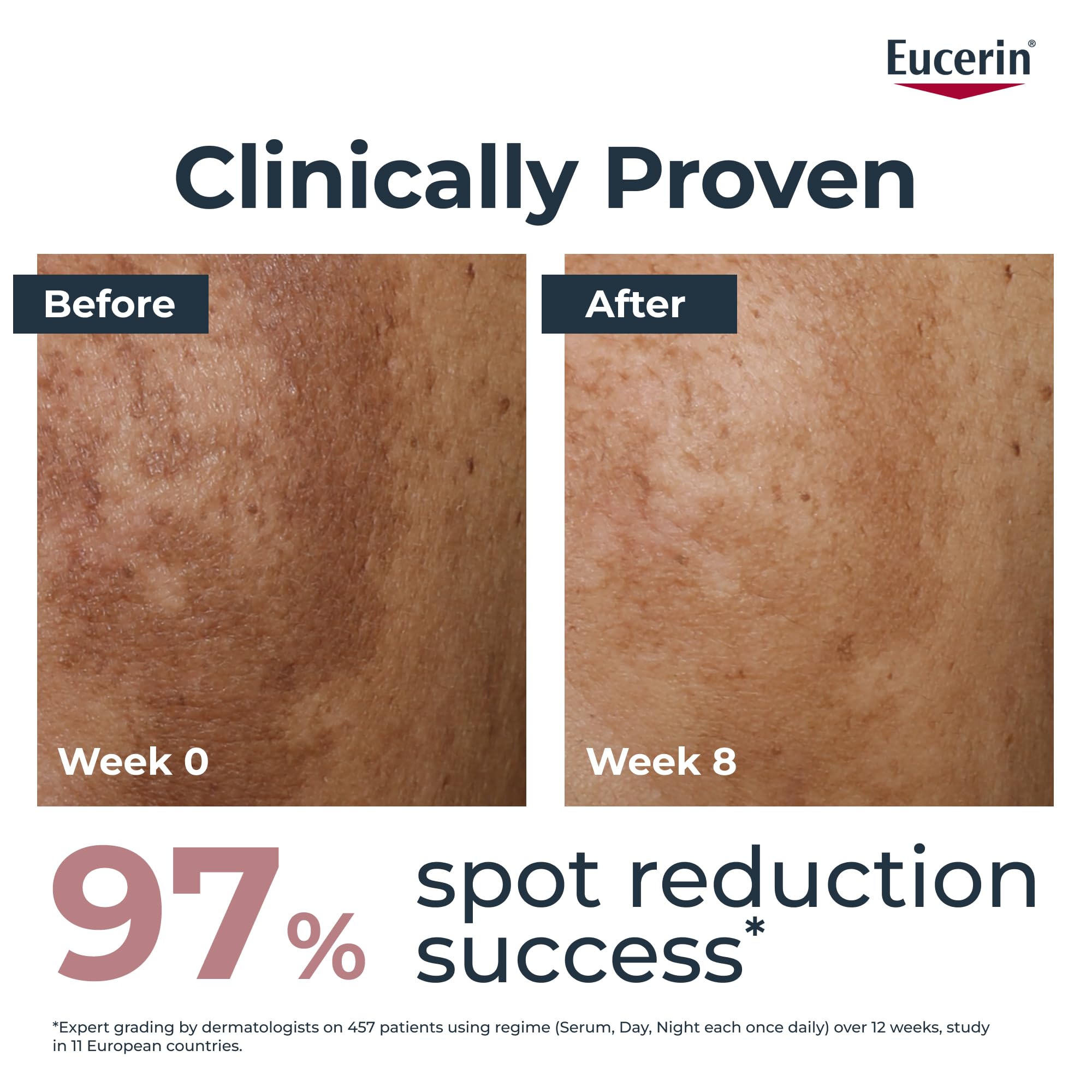 Eucerin Anti-Pigment Dual Serum 30ml, Anti-Pigment Serum for Treatment of Age Spots and Uneven Skin Tone, Advanced Skincare with Hyaluronic Acid
