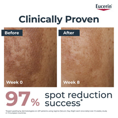 Eucerin Anti-Pigment Dual Serum 30ml, Anti-Pigment Serum for Treatment of Age Spots and Uneven Skin Tone, Advanced Skincare with Hyaluronic Acid