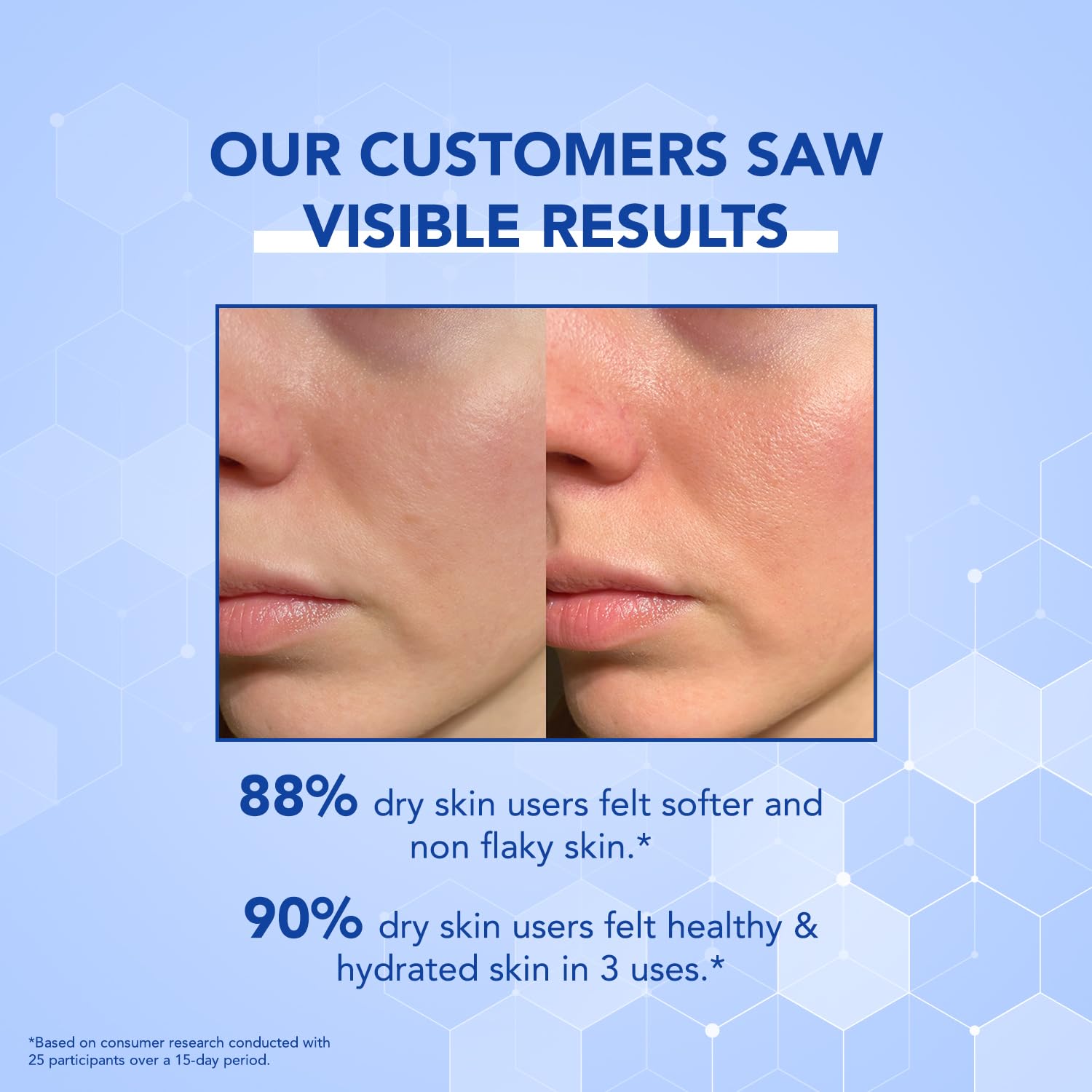 BELLAVITA Face Moisturizer Dry to Normal Skin | Power of 14 Moisturizing Actives | 48hrs Hydration | Intense Moisturization | Repairs & Soothes | pH Balanced | Moisturizer Cream For Men & Women | 50ml
