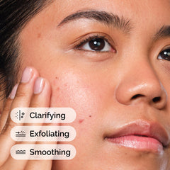 The Ordinary Salicylic Acid 2% Solution, Targeted Serum for Blemish-Prone Skin, 30ml