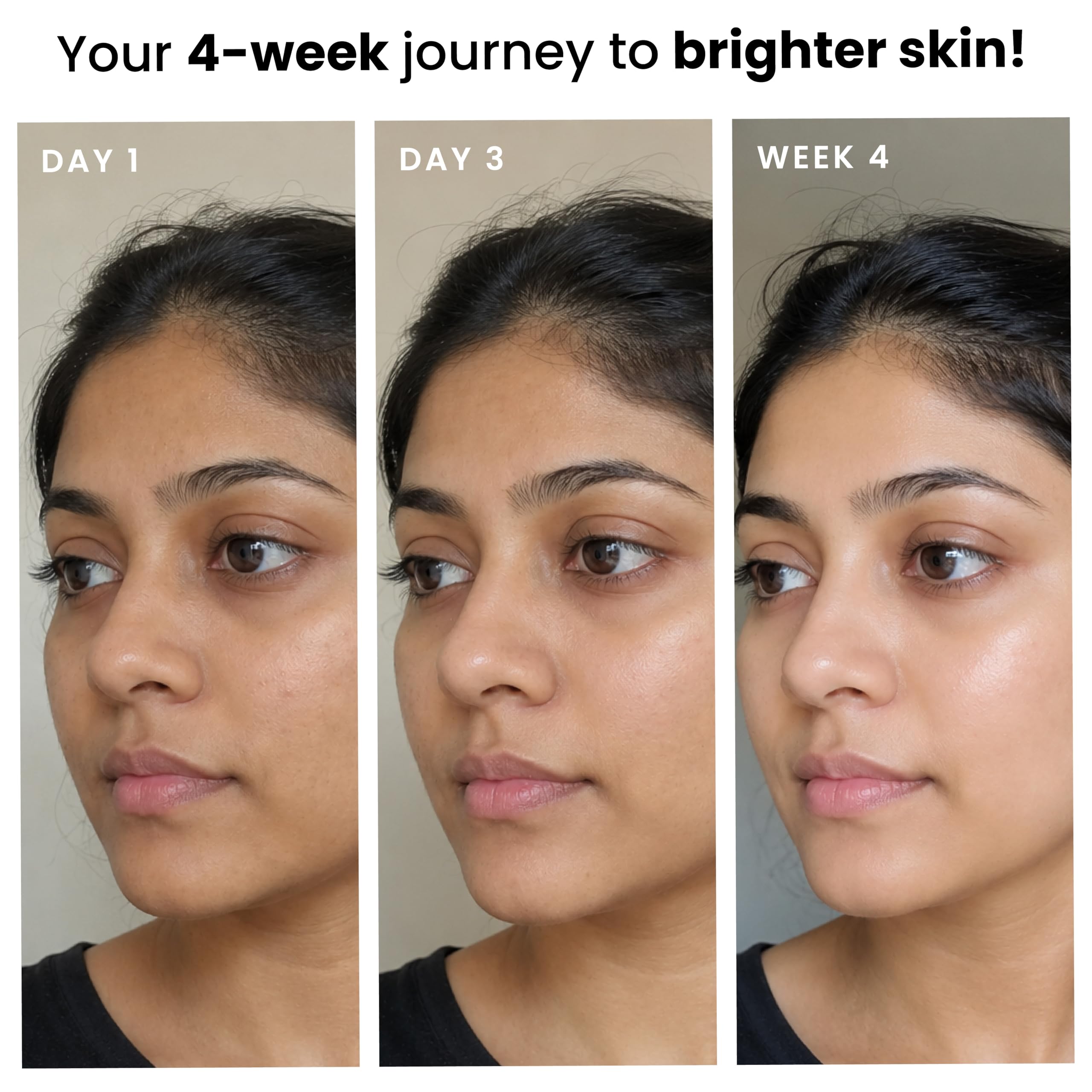 Foxtale Lightweight Brightening Face Moisturiser with Vitamin C & Niacinamide |Brightens & Evens Skin Tone, Fades Dark Spots & Deeply Hydrates | For Normal to Dry Skin | For Men & Women | 50 ml