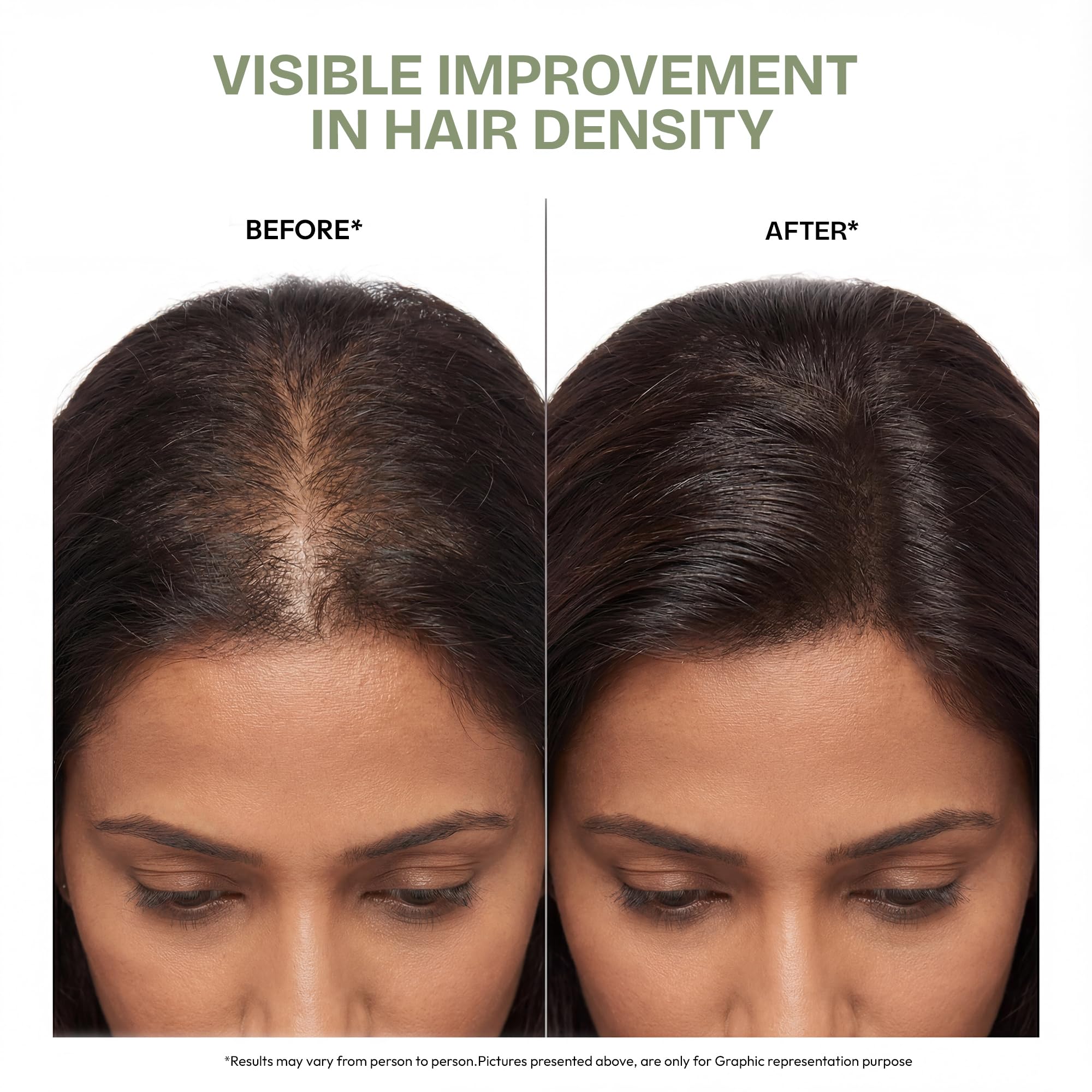 Proskire Ultimate Hair Growth Oil | Lightweight Non-Greasy Hair Growth Oil with Rosemary, Batana & Bhringraj | Reduces Hair Fall & Boosts Hair Density - 100ml
