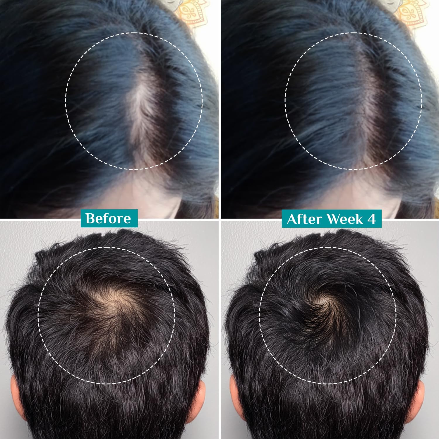Pilgrim Advanced Hair Growth Serum Roll On with Redensyl & AnaGain - 25ml