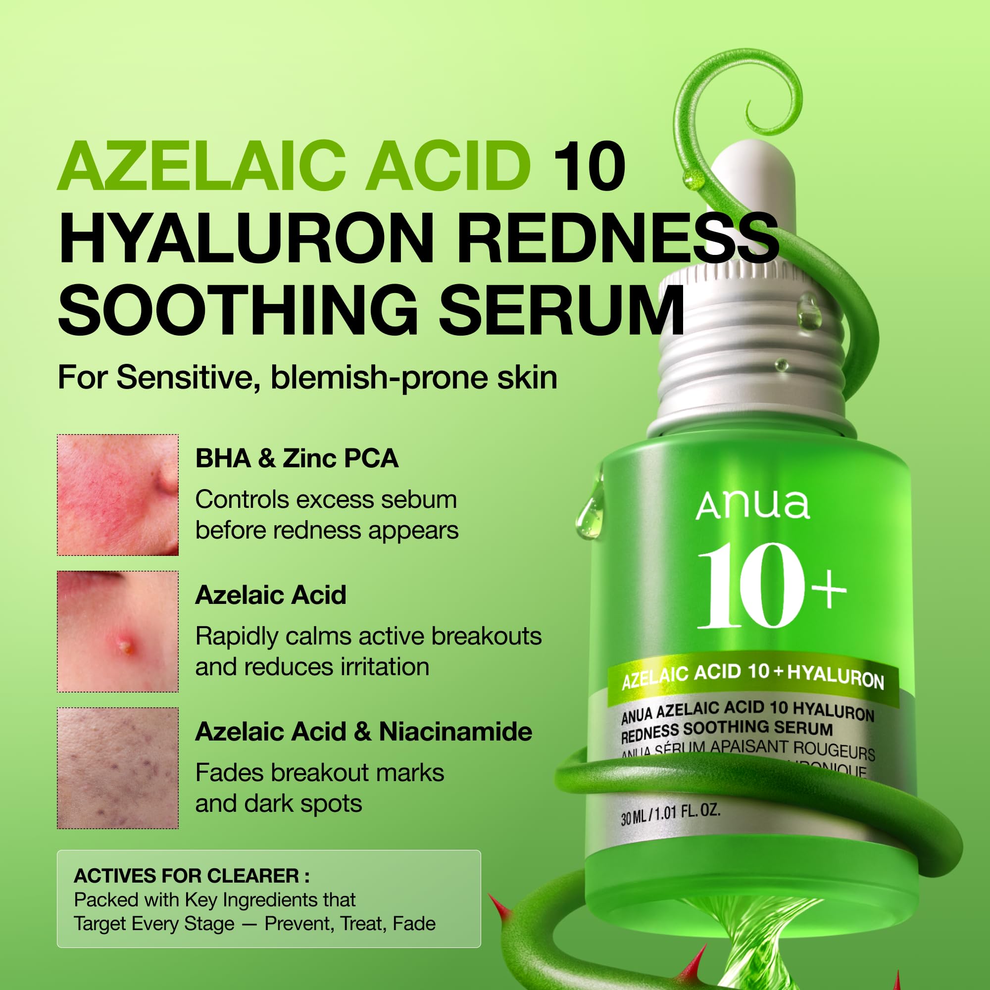Anua Azelaic Acid 10 Hyaluron Redness Soothing Serum with Cica Soothes & Calms Acne-Prone Skin