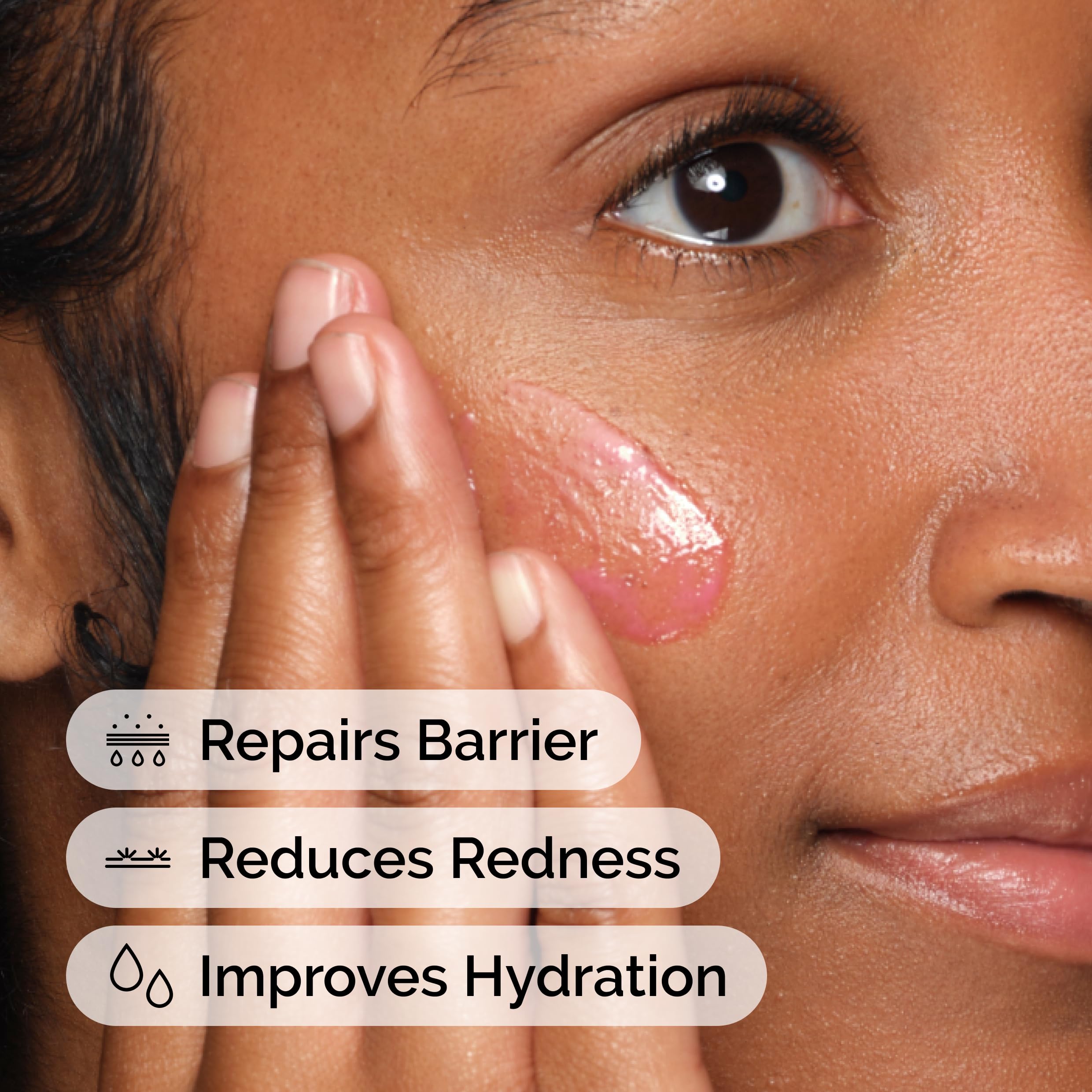 The Ordinary Soothing & Barrier Support Serum, Redness-Reducing & Hydrating Solution for Skin Barrier Recovery, 30ml